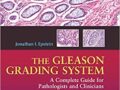 The Gleason Grading System: A Complete Guide for Pathologist and Clinicians (Inglês)