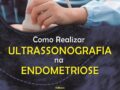 COMO REALIZAR ULTRASSONOGRAFIA NA ENDOMETRIOSE + VIDEO ONLINE Autor: STEFANO GUERRIERO GEORGE CONDOUS JUAN LUIS ALCAZAR