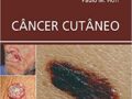 Câncer Cutâneo  2018 por Ricardo Cavalcanti Ribeiro; Paulo M. Hoff Omar Lupi