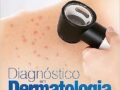 Diagnóstico Em Dermatologia por Maurice Moelleken (Autor), Joachim Dissemond (Autor) 2023