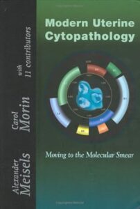 Modern Uterine Cytopathology: Moving to the Molecular Smear Capa dura – 30 janeiro 2007 Edição Inglês por Alexander Meisels (Autor), Carol Morin (Au